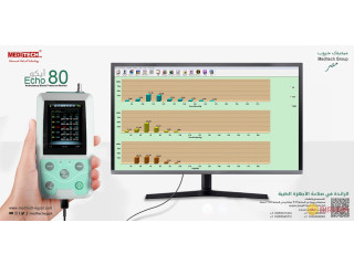 هولتر قياس ضغط الدم ECHO80